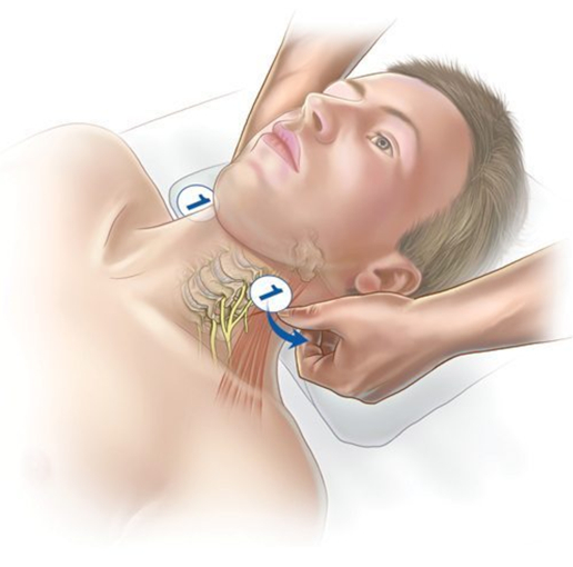 NST - NeuroStructural Integration Technique en Suisse